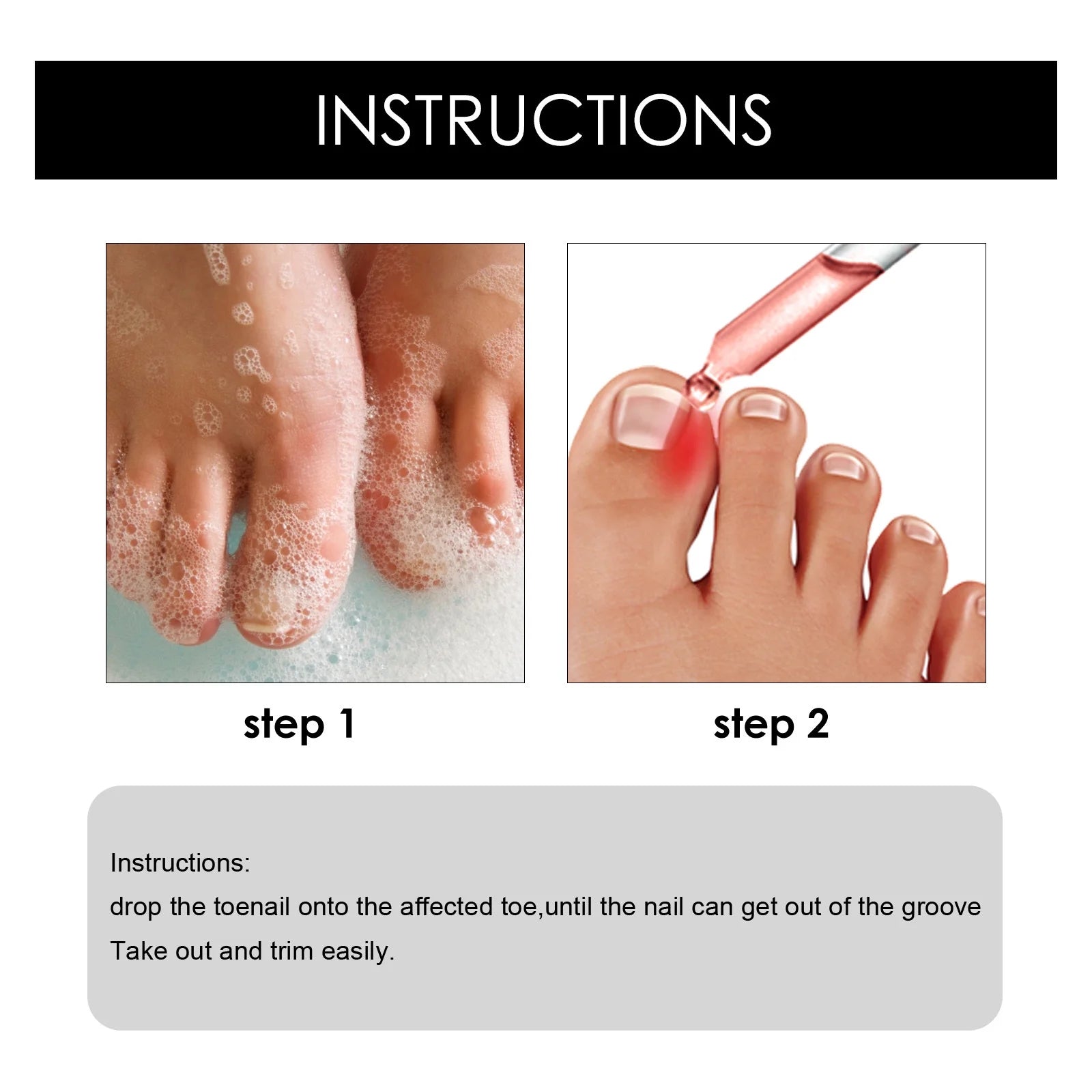 NailDrops® | 87% Experienced Relief From Ingrown Toenail Pain in Just 7 Days