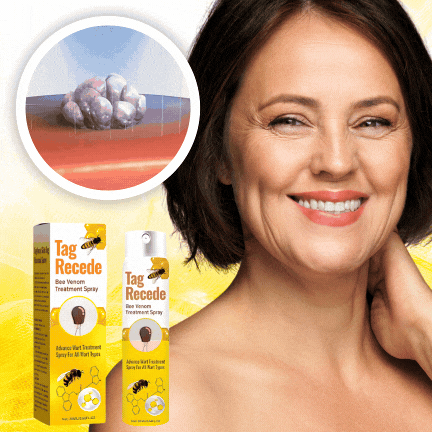 Bee Venom Treatment Spray completely removes skin tags in just 7 days and promotes natural skin regeneration!