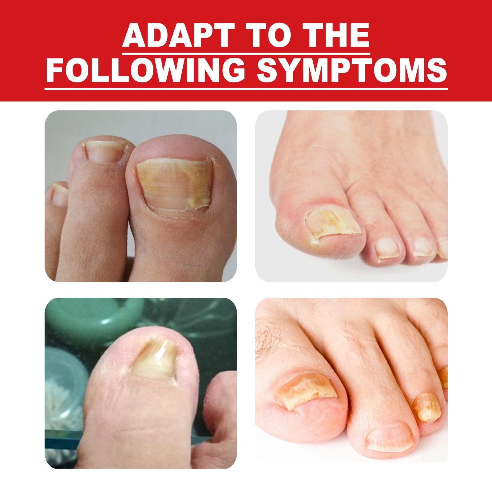 NailDrops® | 87% Experienced Relief From Ingrown Toenail Pain in Just 7 Days