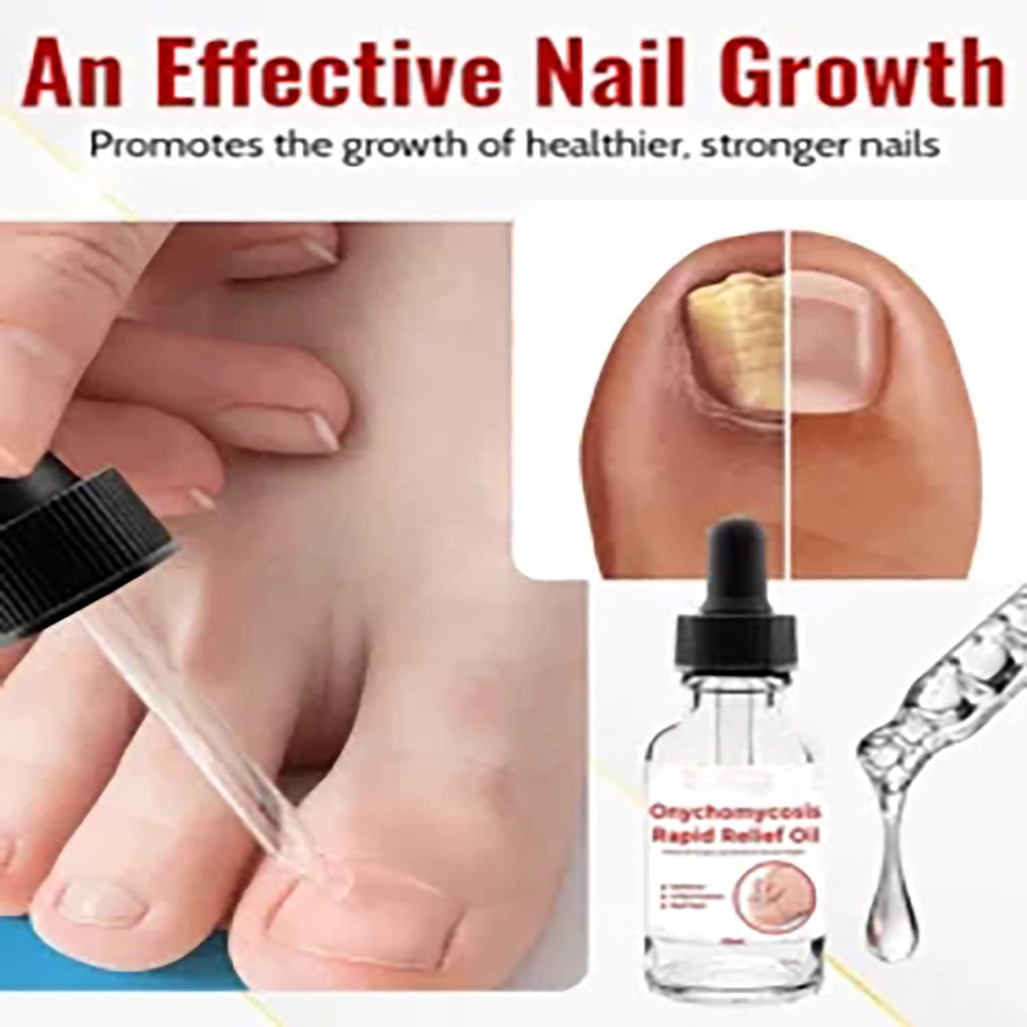 ReNail Rapid Relief Oil® | 89% Saw Clearer, Healthier Nails in Just 7 Days