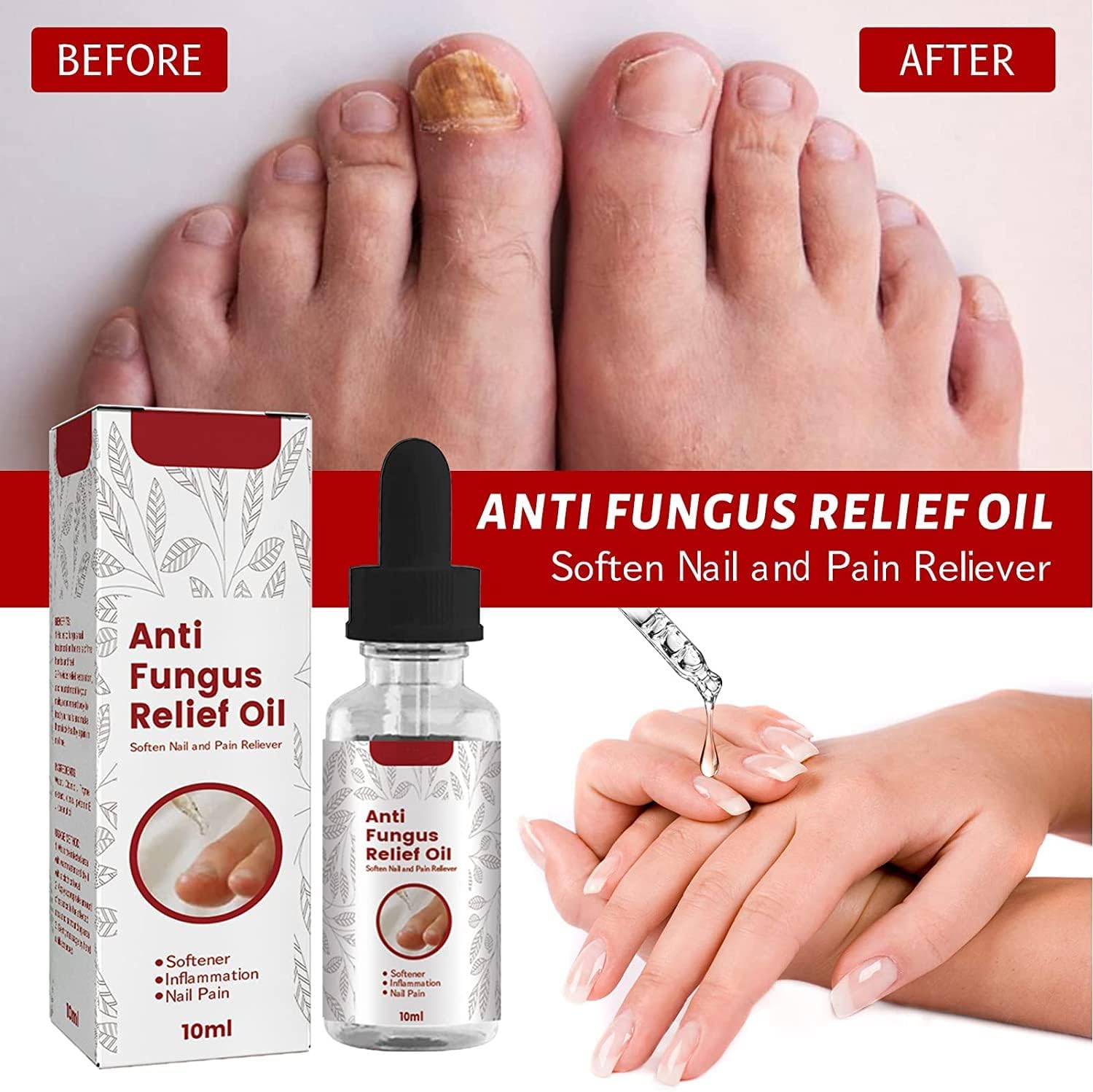 ReNail Rapid Relief Oil® | 89% Saw Clearer, Healthier Nails in Just 7 Days