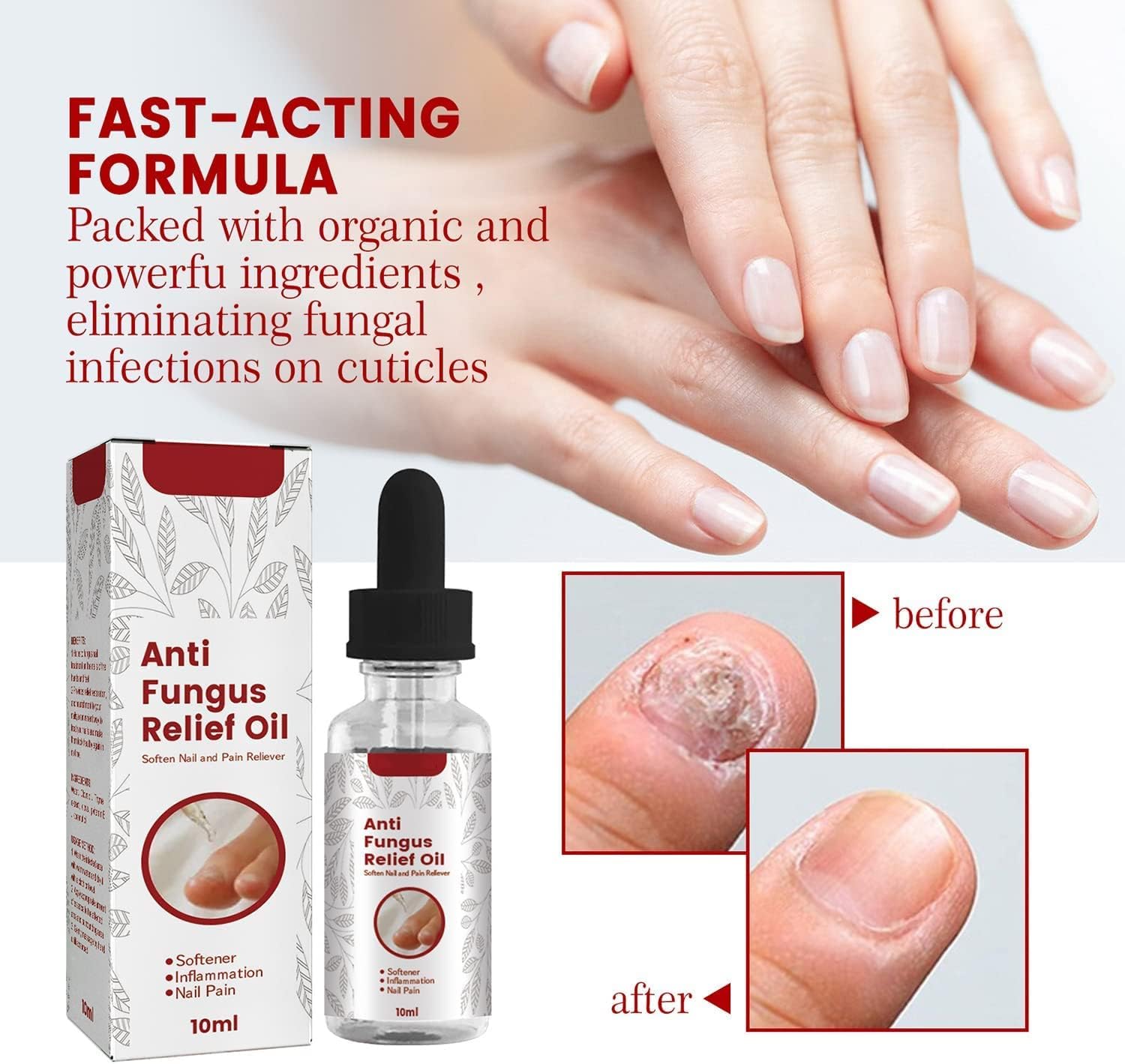 ReNail Rapid Relief Oil® | 89% Saw Clearer, Healthier Nails in Just 7 Days