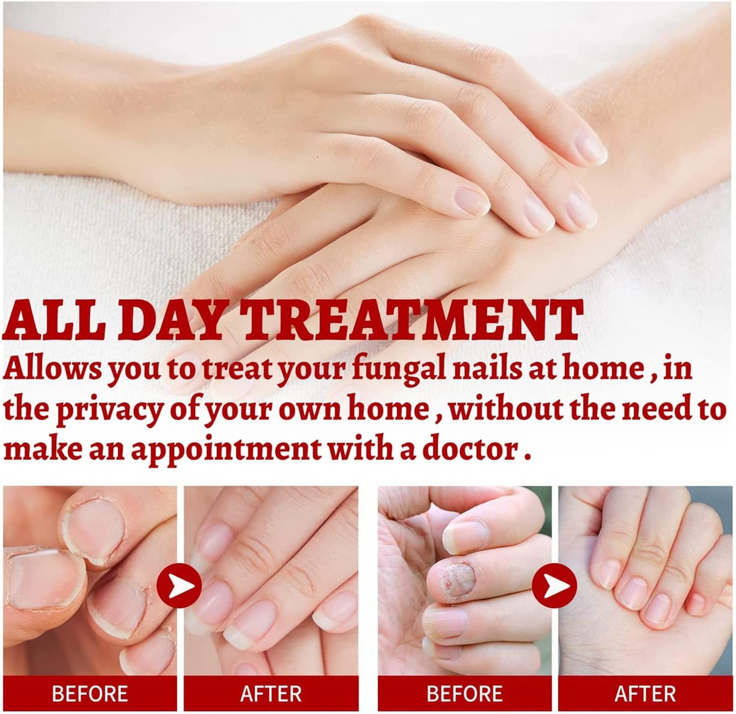 ReNail Rapid Relief Oil® | 89% Saw Clearer, Healthier Nails in Just 7 Days