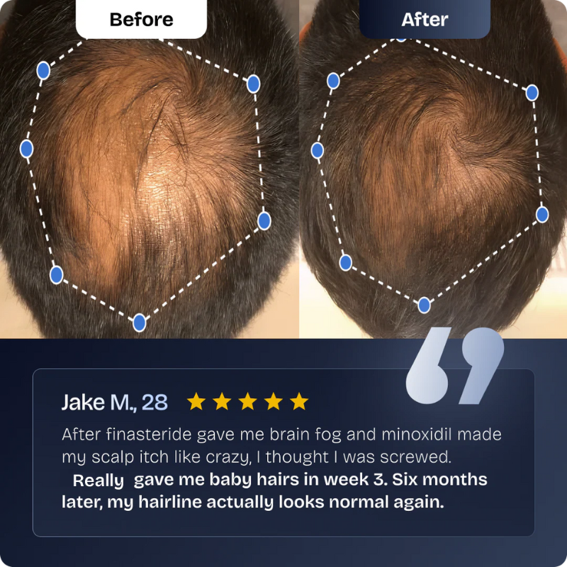 Hair Growth Serum Roll-on – Thicker, Fuller, Stronger Hair