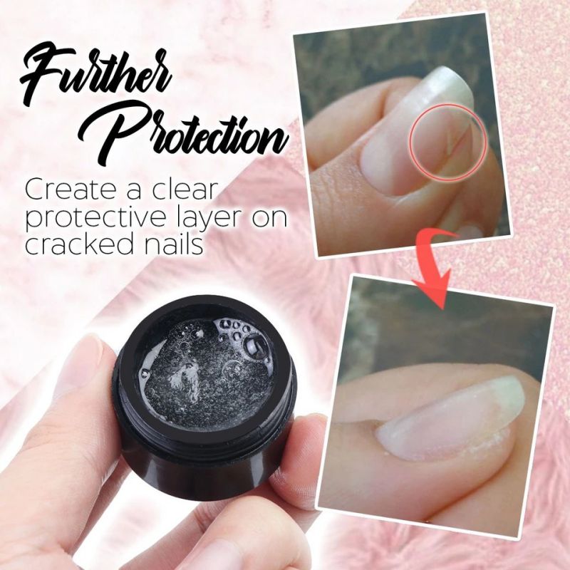 Fixie | Instant Nail Repair Gel