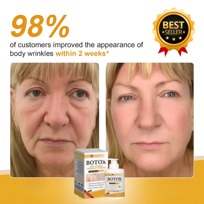 VenoFirm | Smooths Deep Wrinkles and Lifts Sagging Skin for a Youthful Look in 24 Hours