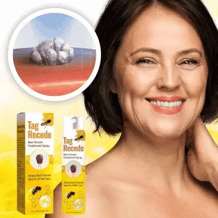 Bee Venom Treatment Spray completely removes skin tags in just 7 days and promotes natural skin regeneration!