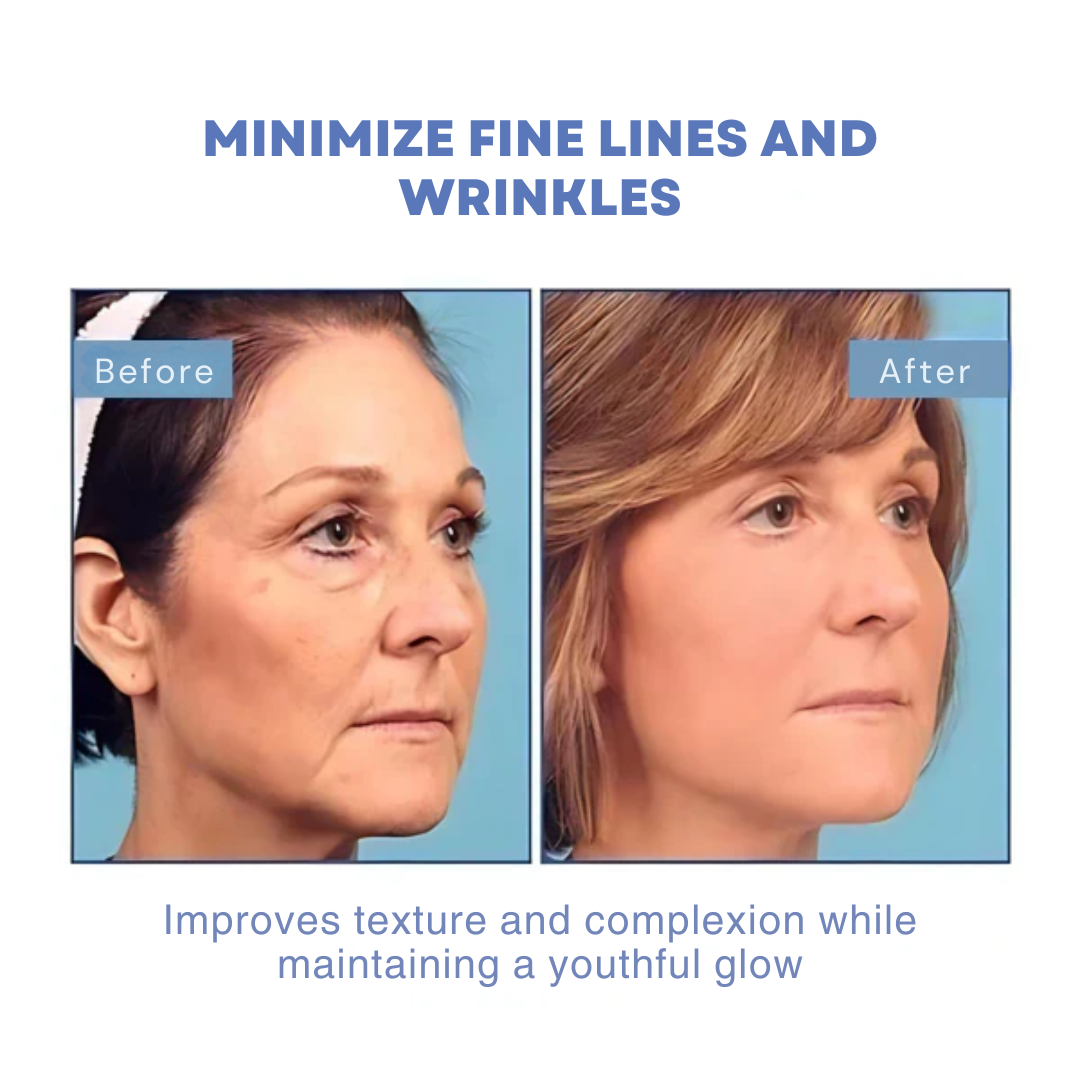 SkinLift | 7 Day Visible Botox Face Serum