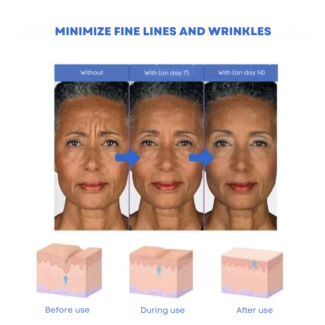SkinLift | 7 Day Visible Botox Face Serum