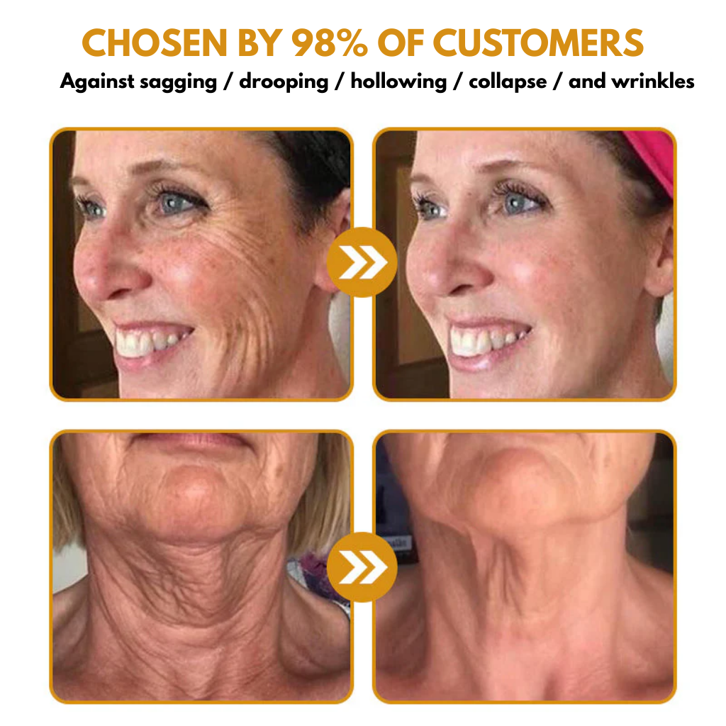 Botox Wrinkle Removal Cream – Look 10 Years Younger in Just Weeks!
