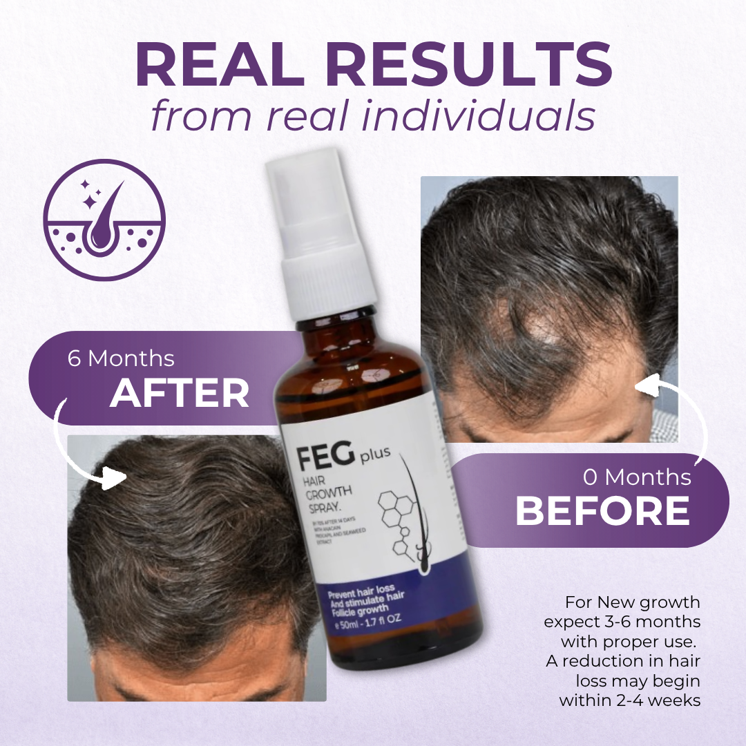 The #1 Remedy Against Hair Loss – See the First Signs of Regrowth in 3 Weeks!