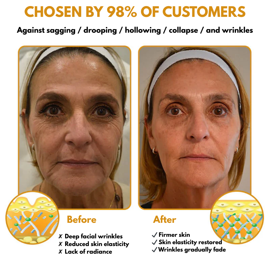 Botox Wrinkle Removal Cream – Look 10 Years Younger in Just Weeks!