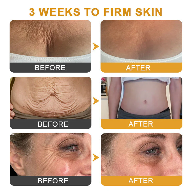 VenoFirm | Smooths Deep Wrinkles and Lifts Sagging Skin for a Youthful Look in 24 Hours