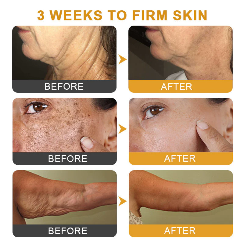VenoFirm | Smooths Deep Wrinkles and Lifts Sagging Skin for a Youthful Look in 24 Hours