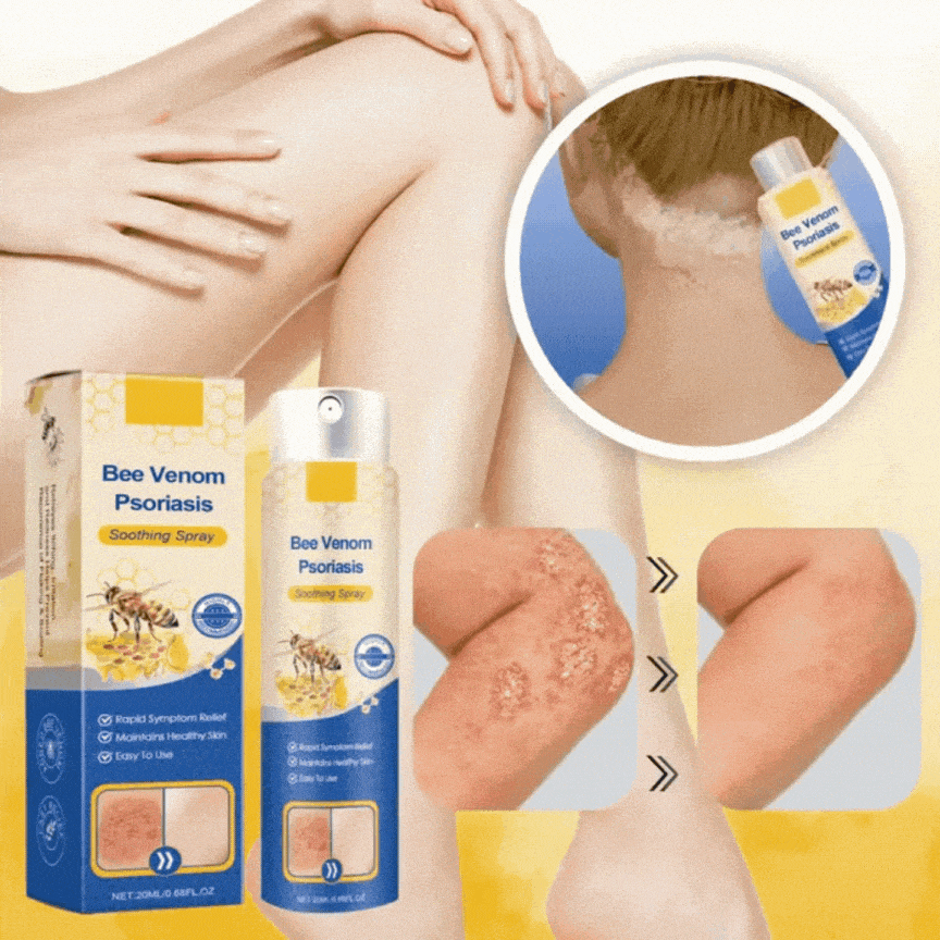 Bee Venom Soothing Spray - relieves itching and flaking and improves the appearance of psoriasis skin by up to 95% in just 2 weeks