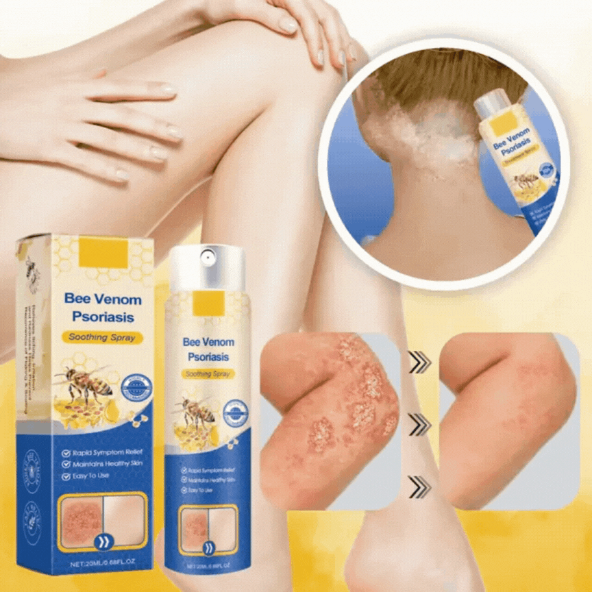 Bee Venom Soothing Spray - relieves itching and flaking and improves the appearance of psoriasis skin by up to 95% in just 2 weeks