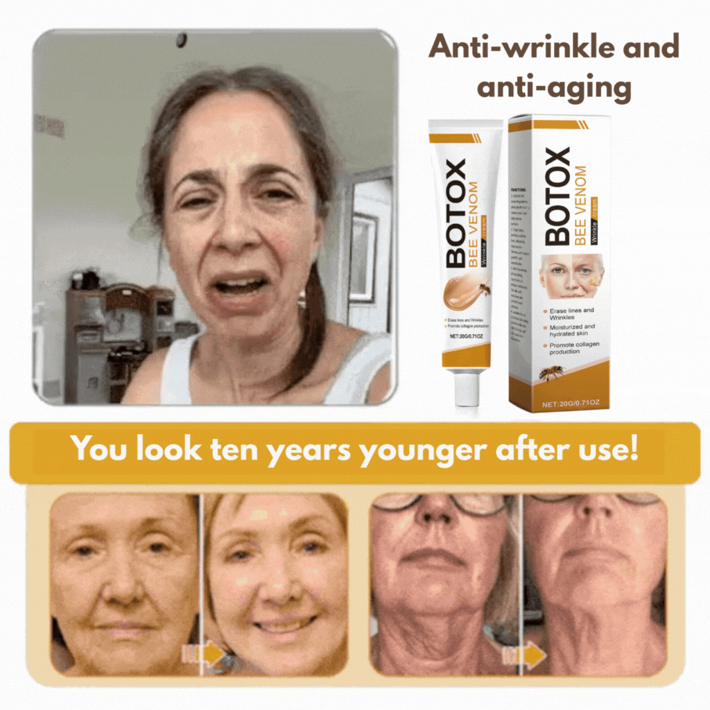 Botox Wrinkle Removal Cream – Look 10 Years Younger in Just Weeks!