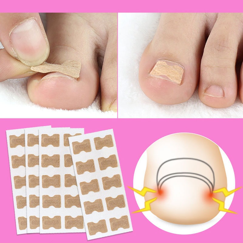EasyPaster - Correction Plaster for Beautiful and Healthy Nails